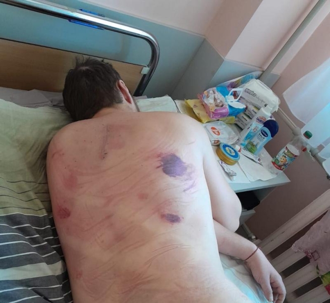 Боєць, якому через поранення паралізувало ноги й пів тіла, зустрів в лікарні своє кохання: у воїна з’явився шанс знову ходити