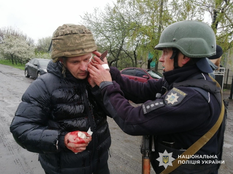 У поліцейських полетіли гранати: на Дніпропетровщині поранено п’ятьох правоохоронців (фото)
